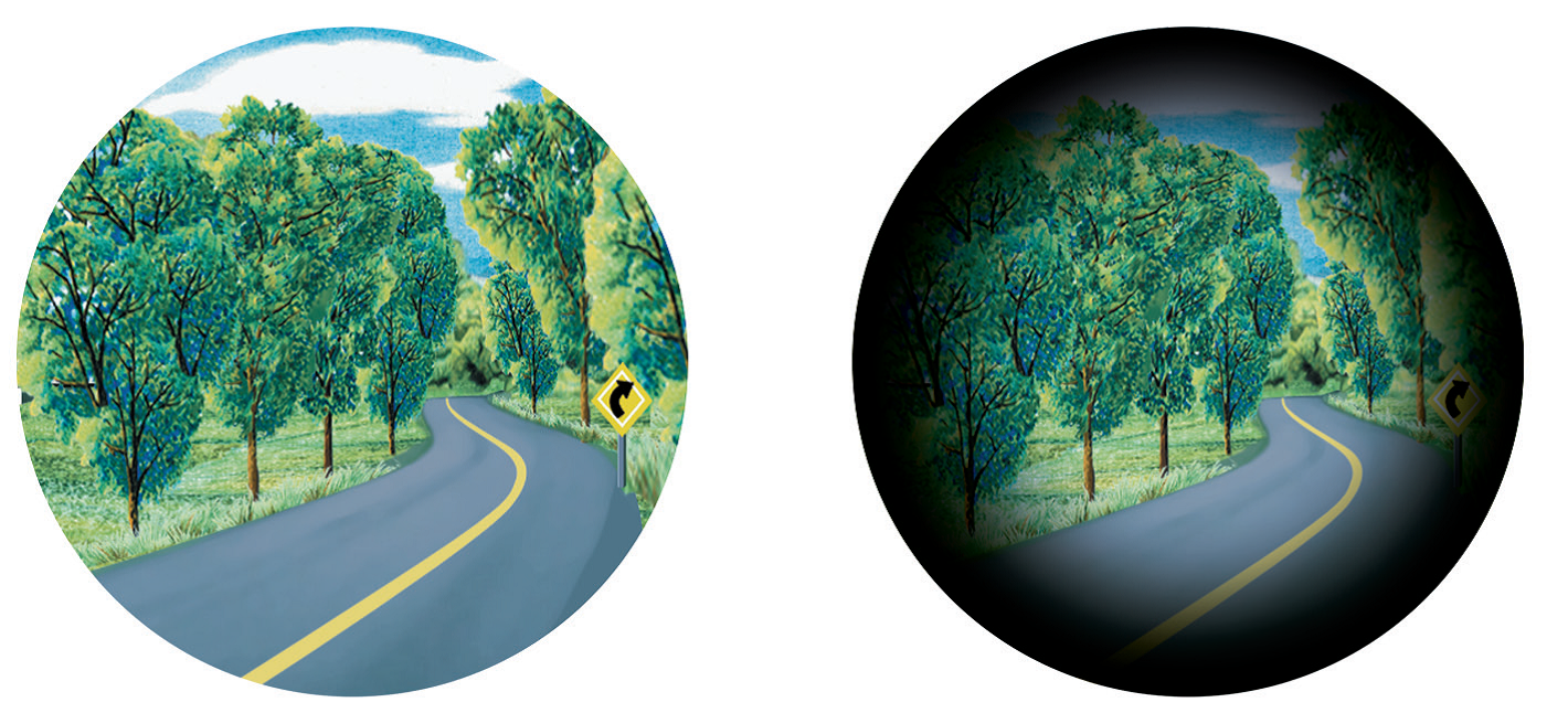 Zbadaj wzrok w kierunku jaskry zanim